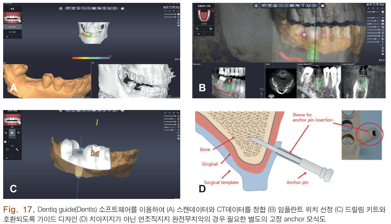 HSMCB1_2018_v27n2_82_f0004.png 이미지