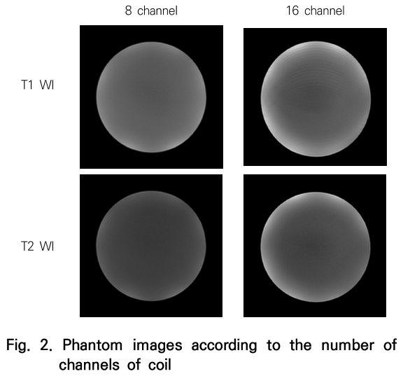 CCTHCV_2019_v19n6_418_f0002.png 이미지