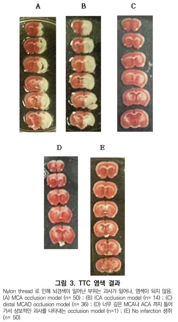 CCTHCV_2019_v19n7_186_f0003.png 이미지